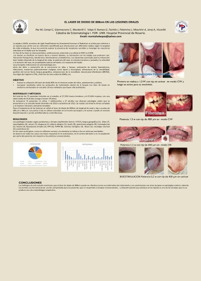 Read more about the article EL LASER DE DIODO DE 808nm EN LAS LESIONES ORALES