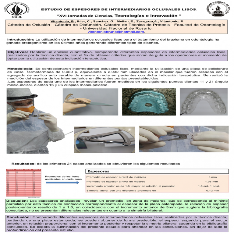 Read more about the article ESTUDIO DE ESPESORES DE INTERMEDIARIOS OCLUSALES LISOS