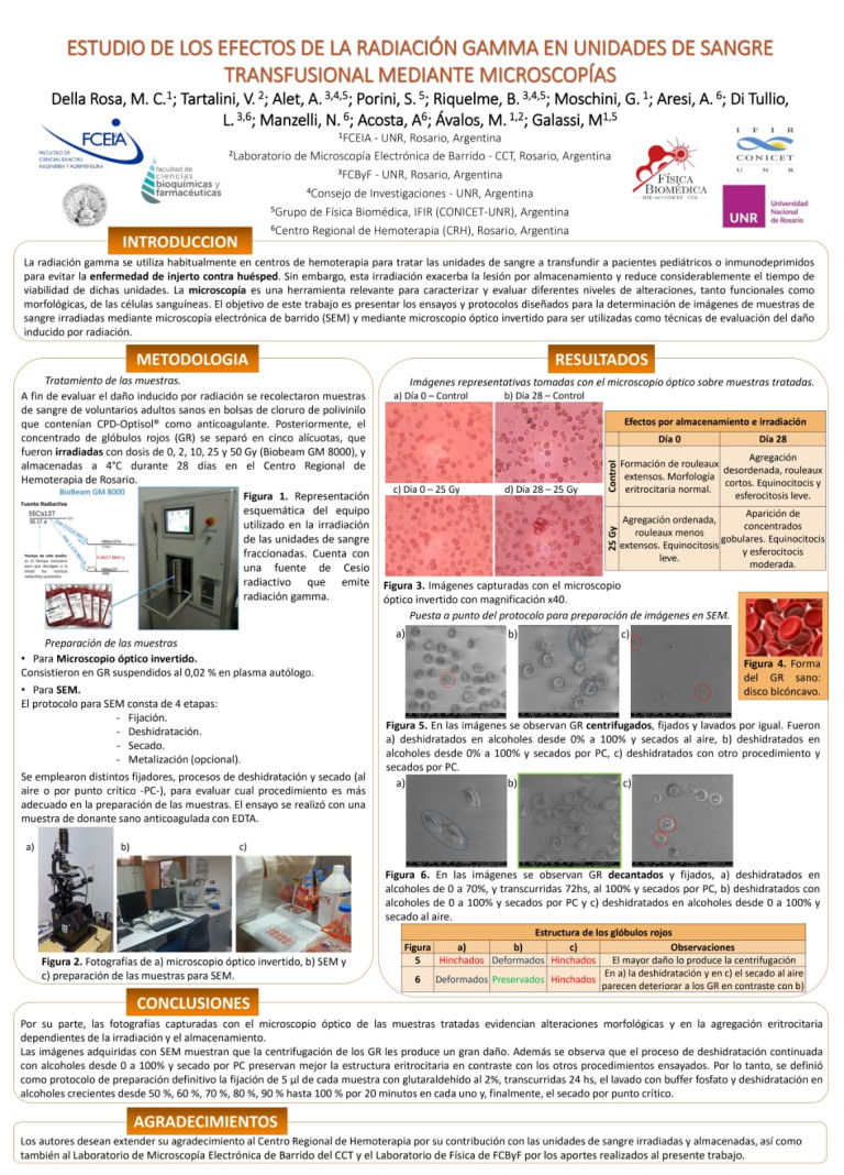 Read more about the article ESTUDIO DE LOS EFECTOS DE LA RADIACIÓN GAMMA EN UNIDADES DE SANGRE TRANSFUSIONAL MEDIANTE MICROSCOPÍA