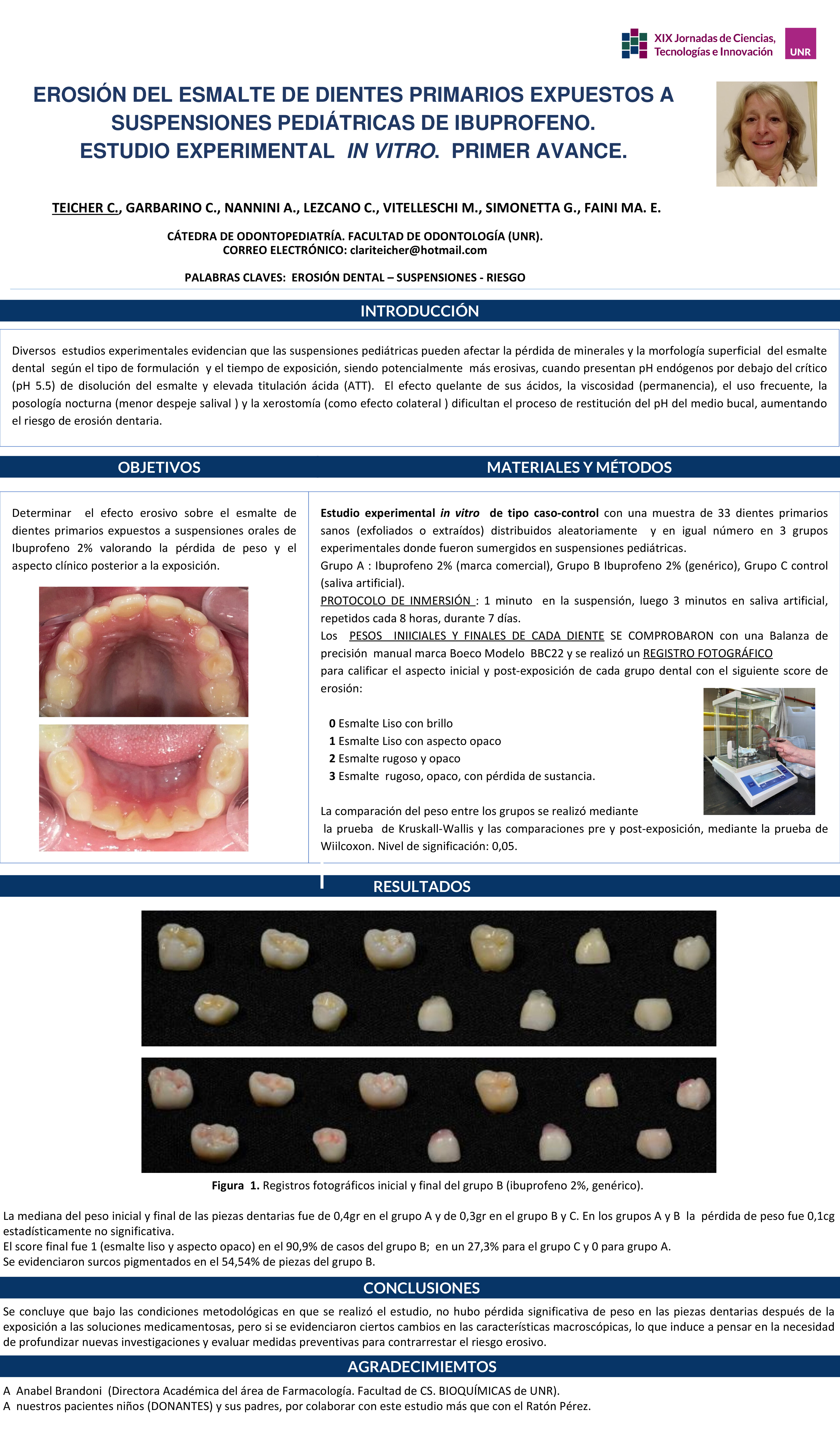 Lee más sobre el artículo EROSIÓN DEL ESMALTE DE DIENTES PRIMARIOS EXPUESTOS A SUSPENSIONES PEDIÁTRICAS DE IBUPROFENO. ESTUDIO EXPERIMENTAL IN VITRO. PRIMER AVANCE.